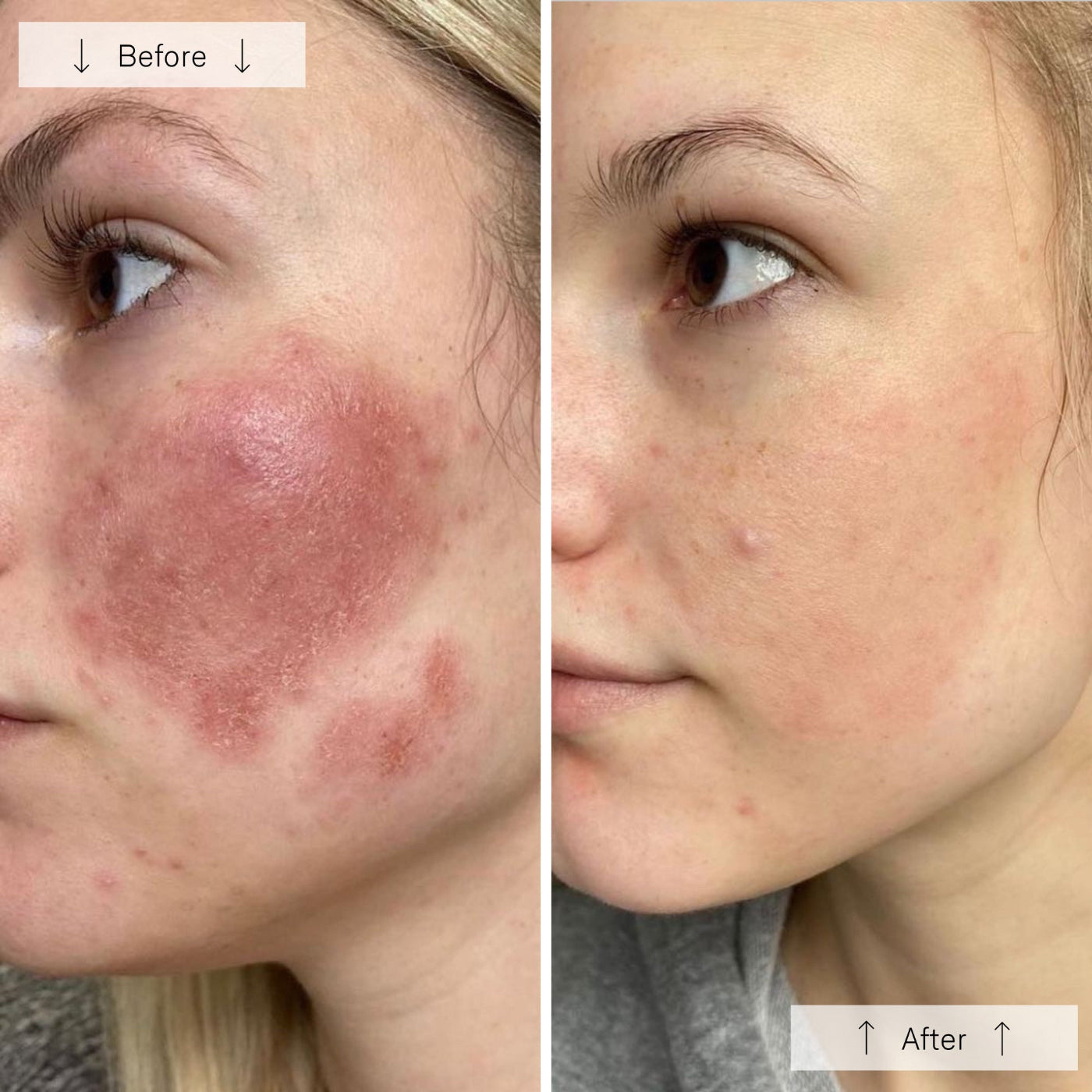 OmniLux Contour Mask
