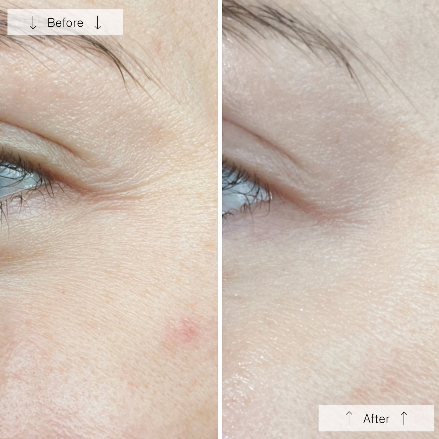 OmniLux Contour Mask