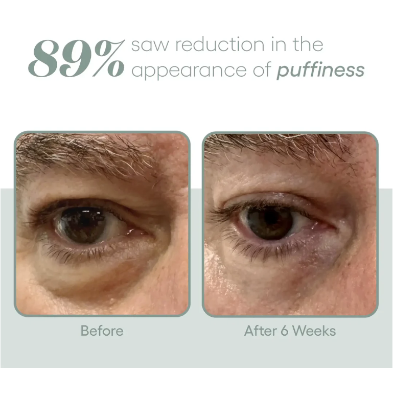 EYE Serum