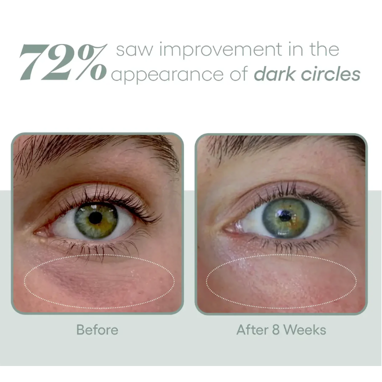 EYE Serum